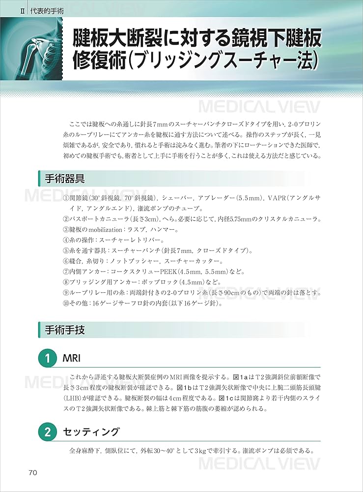 肩の鏡視下手術 改訂第2版 (ゼロからマスター) | 中川 照彦 |本 | 通販