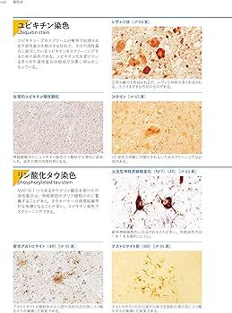 神経病理インデックス 第2版 | 新井信隆, 新井信隆 |本 | 通販 | Amazon