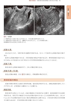 81vszZ-tVLL._AC_UF350,