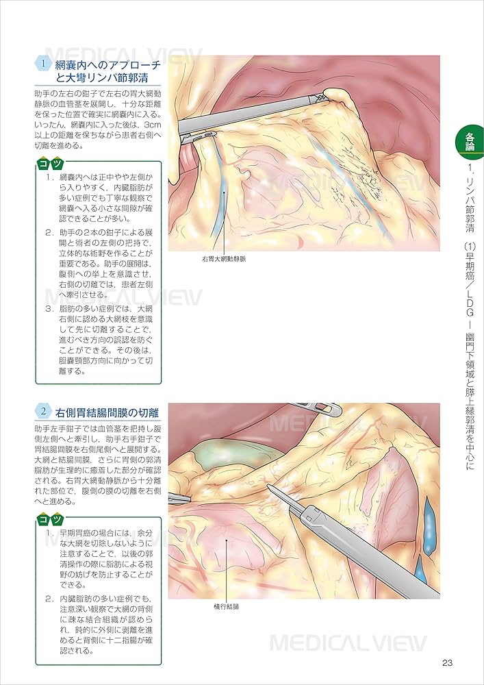 令和スタイル 鏡視下 胃手術のすべて | 比企 直樹, 布部 創也 |本