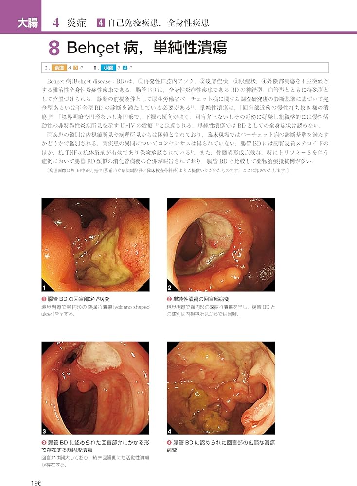 胃と腸アトラスII 下部消化管 第3版 | 「胃と腸」編集委員会, 松本 主