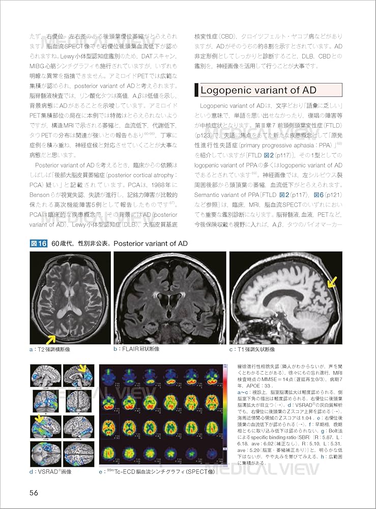 画像で究める認知症 | 德丸 阿耶 |本 | 通販 | Amazon