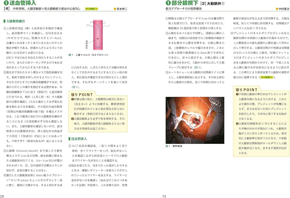 低侵襲心臓手術テクニック WEB動画135本付き MICS指南：成功は細部に