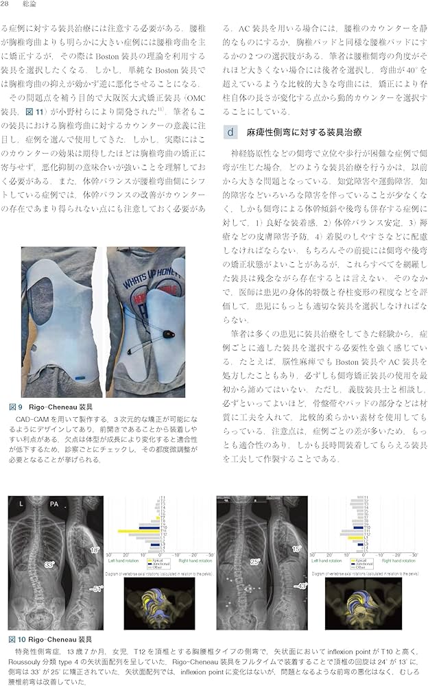 Amazon.co.jp: 症例から学ぶ小児脊柱変形（基礎から難治性疾患まで