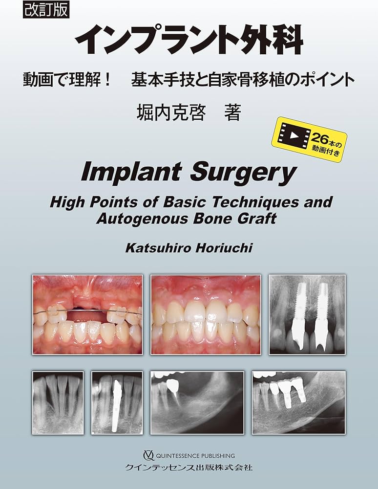Amazon.co.jp: 改訂版 インプラント外科: 動画で理解! 基本手技と自家