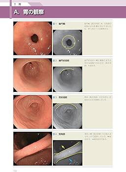 消化管内視鏡診断テキスト I 食道・胃・十二指腸 第5版 (消化器画像