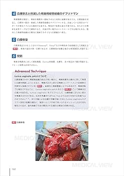 81BeLIvC0zL._AC_UF350,