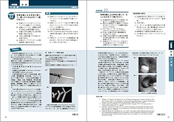必携! 呼吸器専門医試験のための実践問題と解説 | 粟野 暢康, 出雲