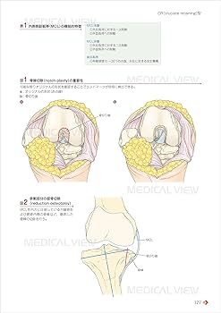 人工膝関節全置換術[TKA]のすべて−より安全に・より確実に | 勝呂 徹
