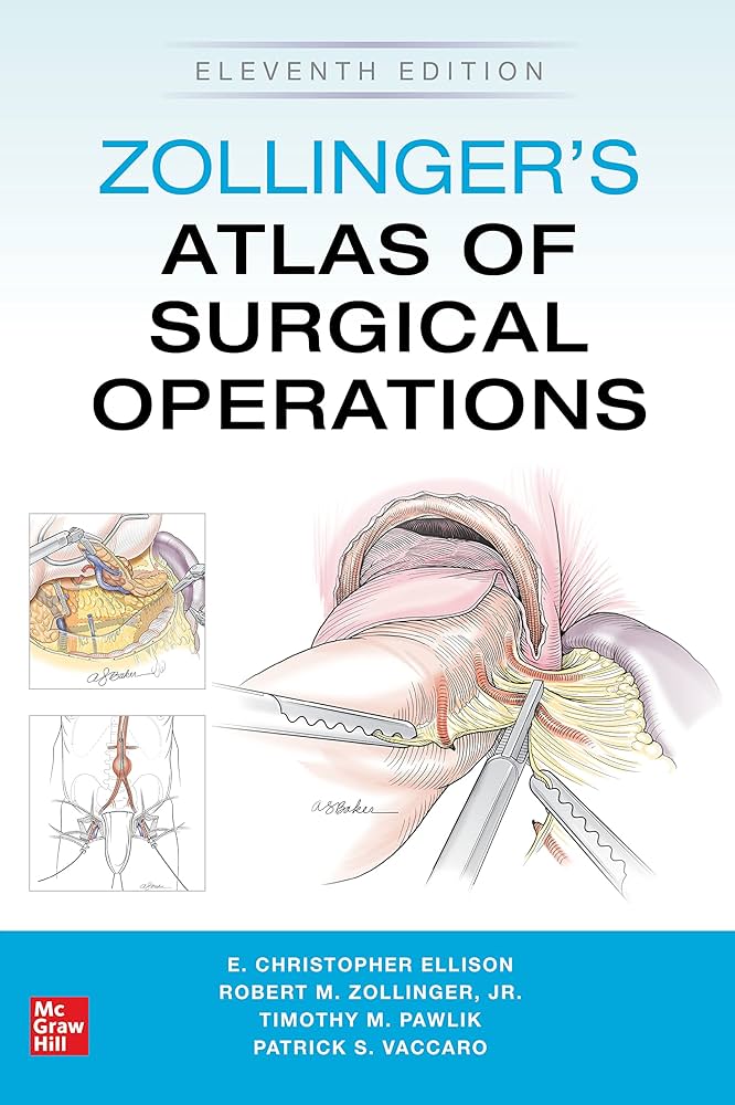 Amazon.co.jp: Zollinger's Atlas of Surgical Operations, Eleventh