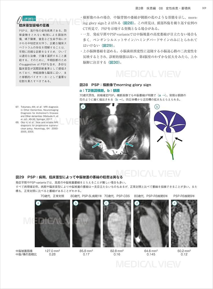 81Dxn1gnlDL._AC_UF1000,