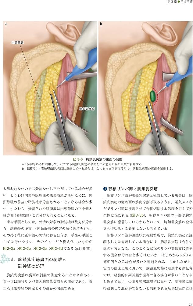 深頸筋膜の解剖学的構造から学ぶ 頸部郭清術 | 西嶌 渡 |本 | 通販