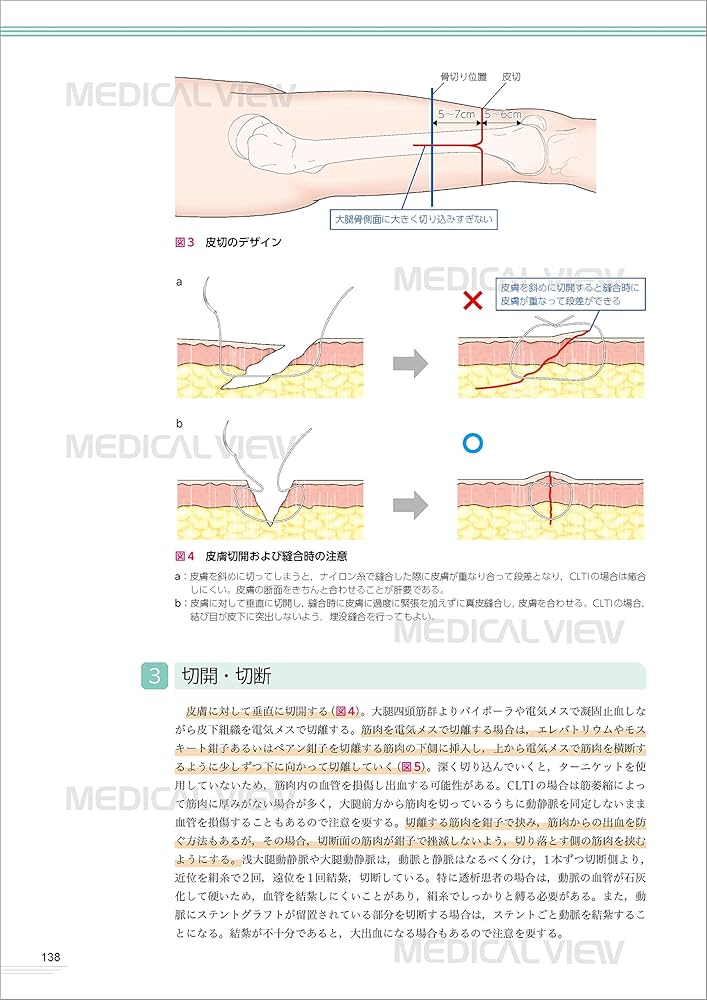四肢切断術のすべて［Web動画付］ | 田中 康仁, 富村 奈津子 |本
