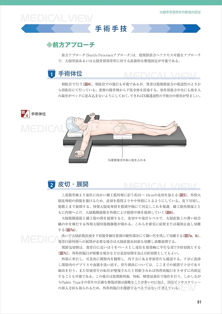 下肢の骨折手術① 骨盤・大腿骨［Web動画付］ (新OS NEXUS No.4