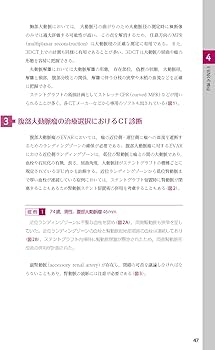 ステントグラフト内挿術マニュアル 腹部編【動画を含む電子版付