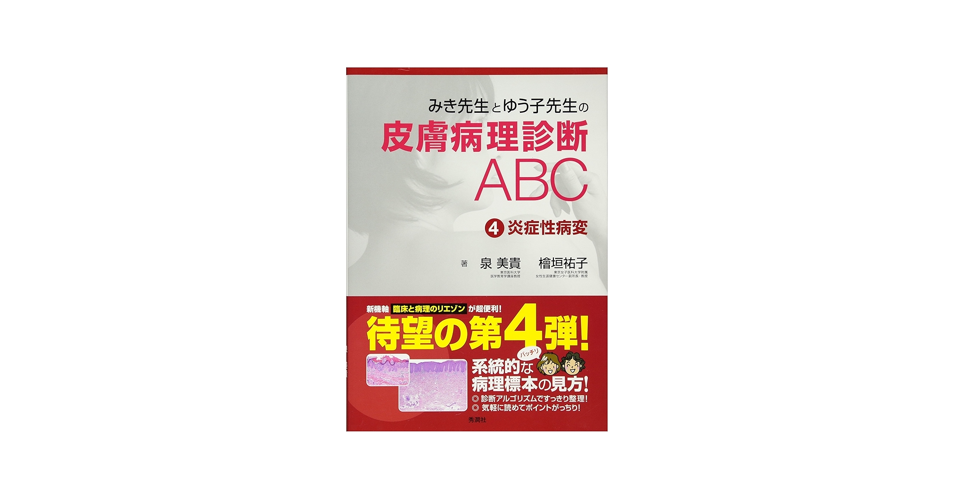 みき先生の皮膚病理診断ABC〈4〉 炎症性病変 | 泉 美貴, 檜垣 祐子 |本