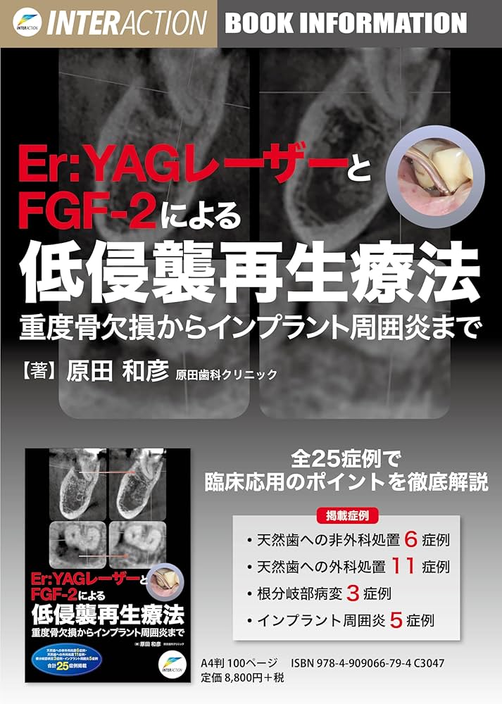 Amazon.co.jp: Er:YAGレーザーとFGF-2による低侵襲再生療法 : 原田