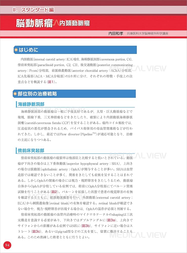 脳血管内治療 スタート&スタンダード | 吉村 紳一 |本 | 通販 | Amazon