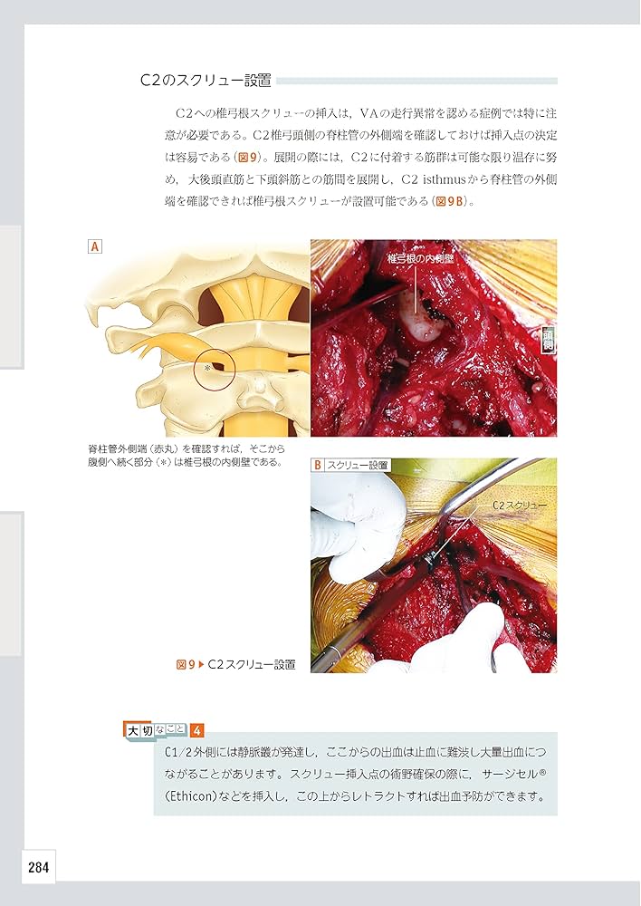 整形外科レジデントのためのベーシック手術 【上肢・脊椎・下肢 3冊合