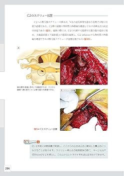 整形外科レジデントのためのベーシック手術 【上肢・脊椎・下肢 3冊合