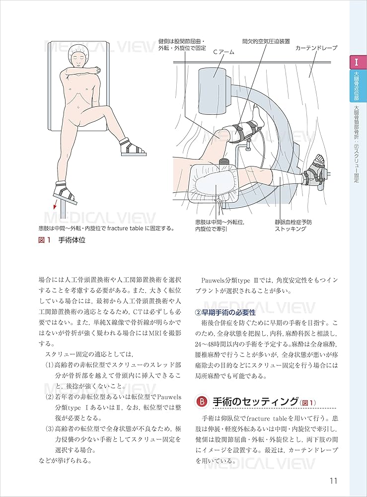 スタンダード骨折手術治療 下肢 | 渡部 欣忍 |本 | 通販 | Amazon