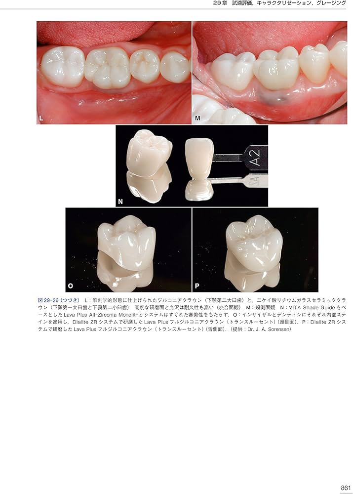 クラウンブリッジの臨床 原著第5版 | Stephen F.Rosenstiel, Martin f