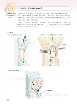 上肢 (新 執刀医のためのサージカルテクニック) | 長尾 聡哉 |本