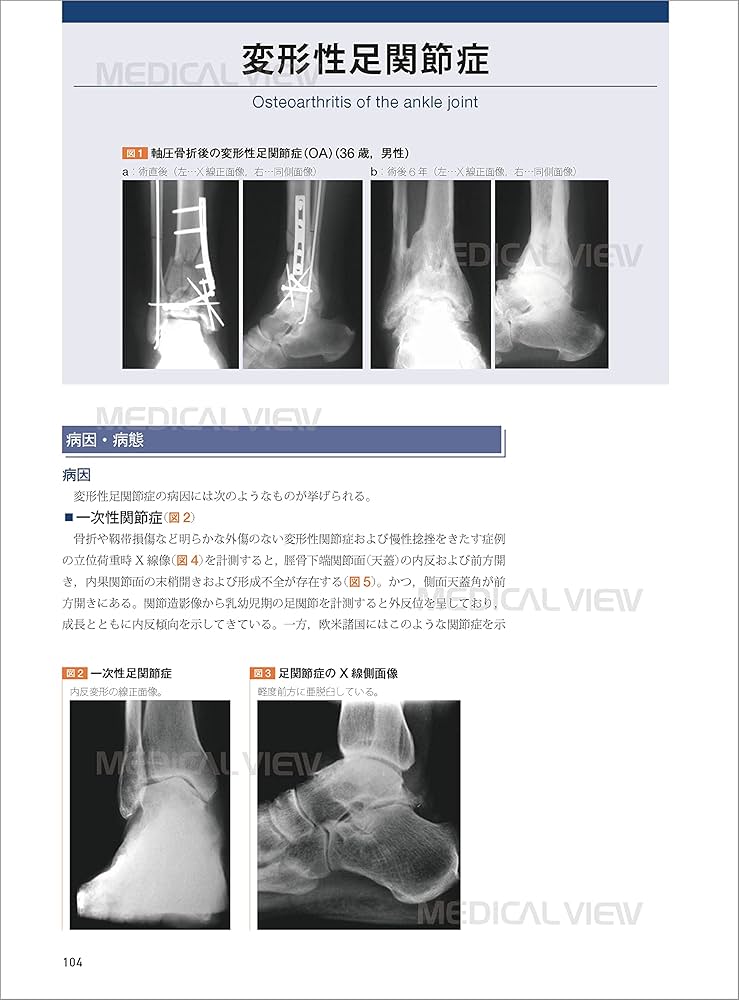 図説 足の臨床−第4版 | 高倉 義典, 田中 康仁, 谷口 晃 |本 | 通販