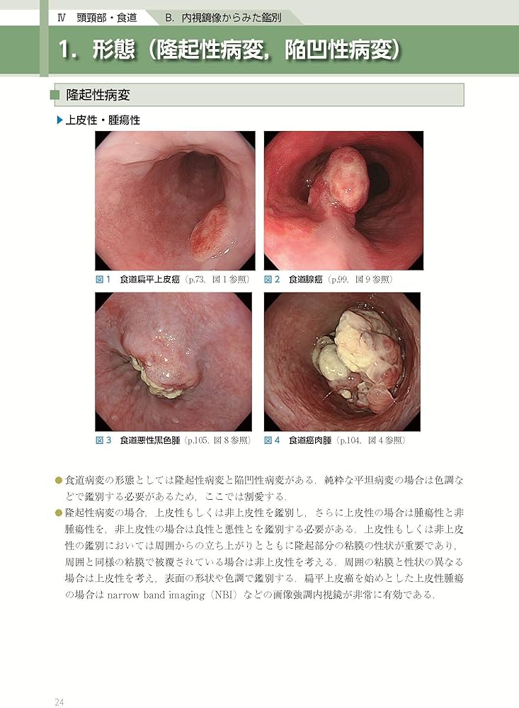 消化管内視鏡診断テキスト I 食道・胃・十二指腸 第5版 (消化器画像