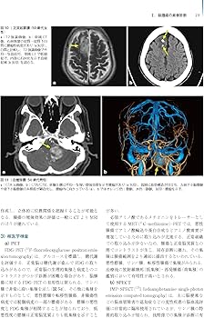 脳腫瘍 第2版(腫瘍病理鑑別診断アトラス) | 横尾 英明, 小森 隆司 |本