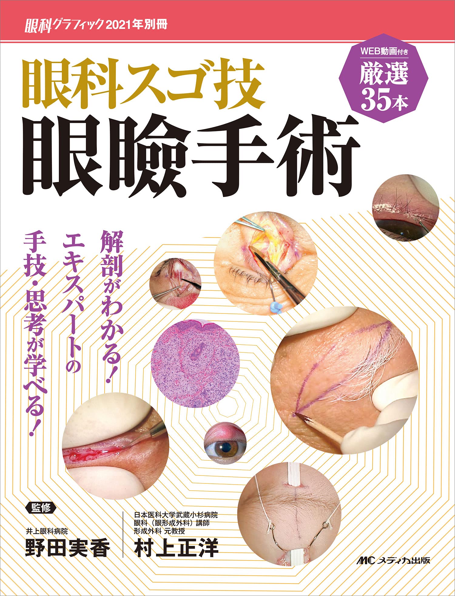 眼科スゴ技 眼瞼手術: WEB動画付き厳選35本付き/解剖がわかる
