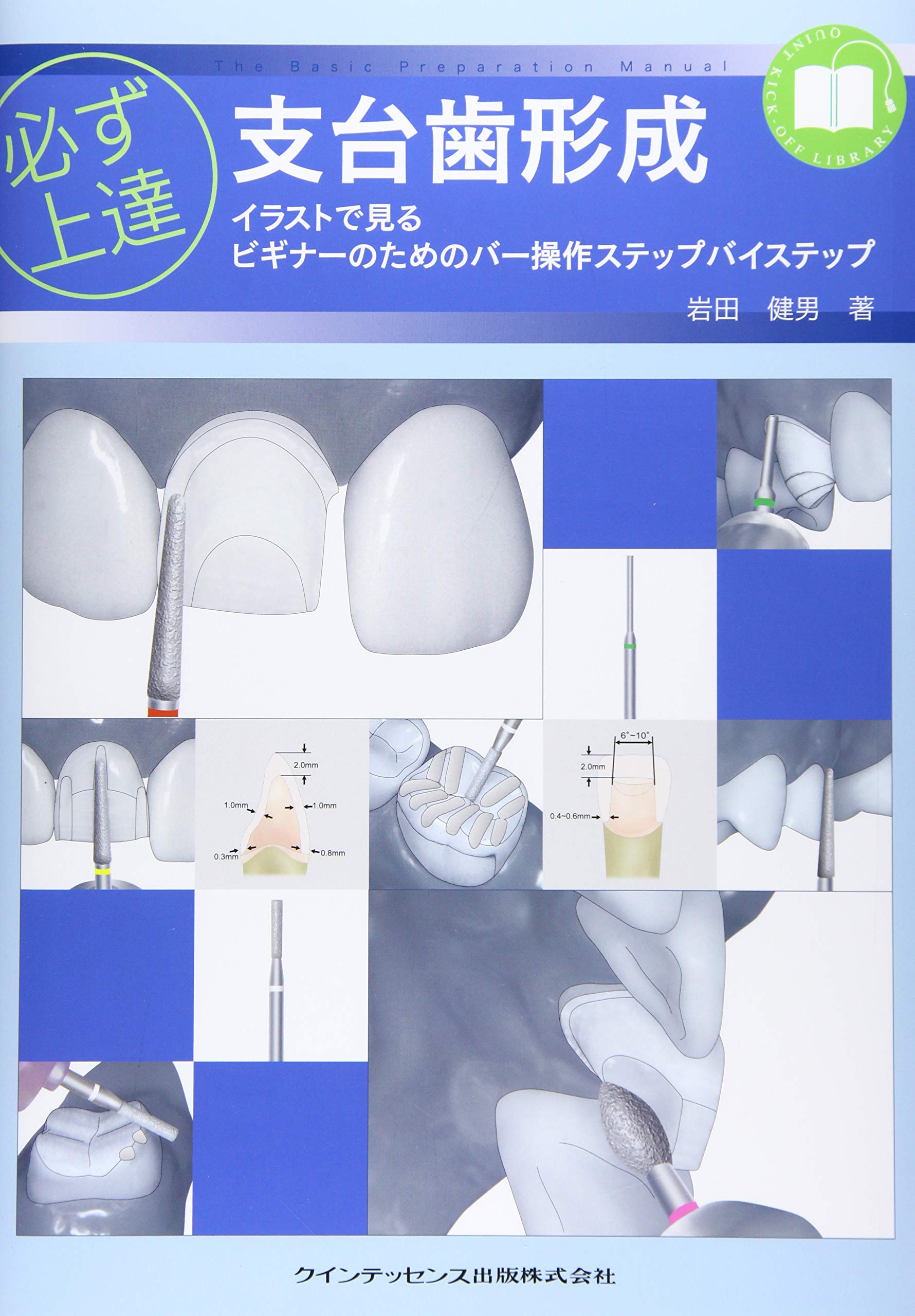 必ず上達 支台歯形成 (必ず上達シリーズ) | 岩田 健男 |本 | 通販 | Amazon