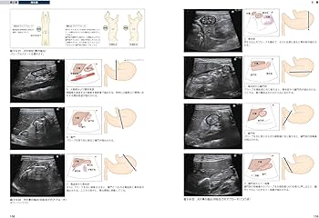 犬と猫のベーシック画像診断学 腹部編 | 獣医放射線学教育研究会 |本