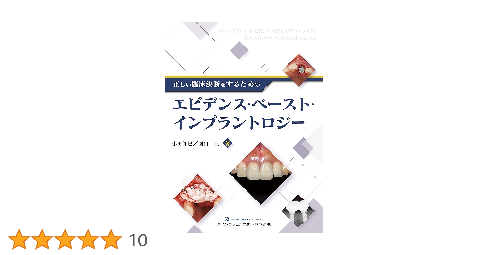 81RzhY+5+CL.jpg_BO30,255,255,