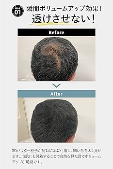 Amazon | HAN.d moir （ 薄毛 白髪 スプレー パウダー / 100g×3 約3