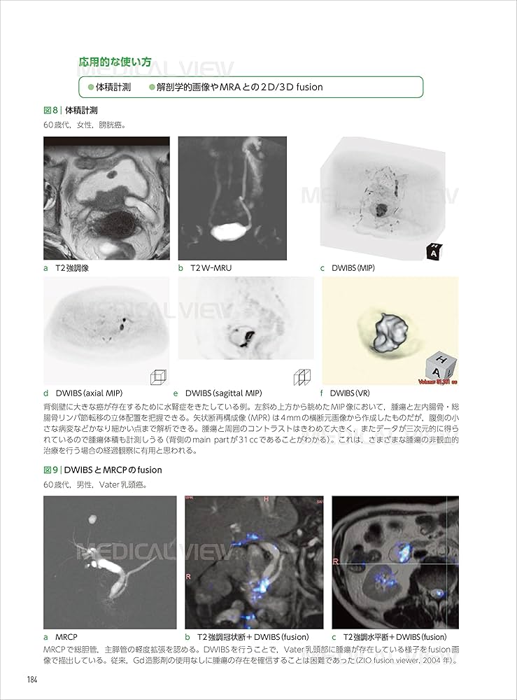 MRI応用自在−第4版 | 高原 太郎, 堀 正明, 本杉 宇太郎 |本 | 通販