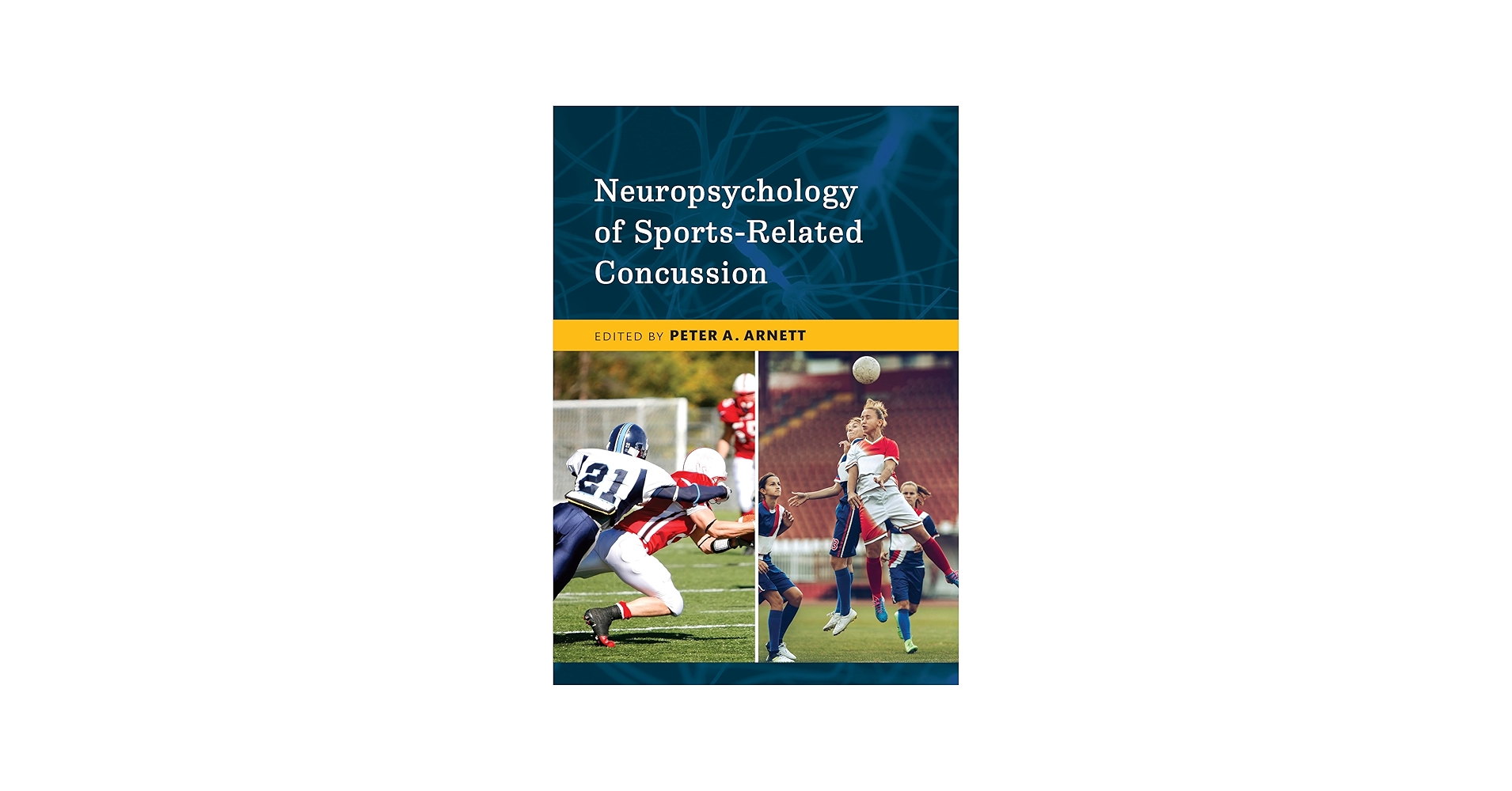 Neuropsychology of Sports-Related Concussion: 9781433829796