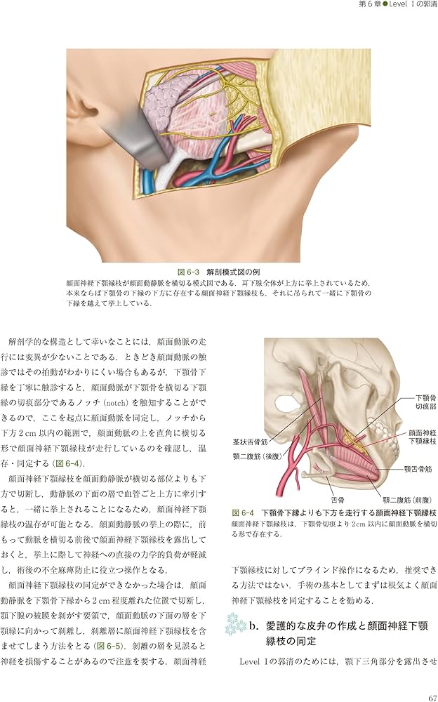 Amazon.co.jp: 深頸筋膜の解剖学的構造から学ぶ 頸部郭清術 : 西嶌 渡