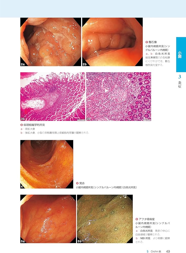 胃と腸アトラスII 下部消化管 第3版 | 「胃と腸」編集委員会, 松本 主