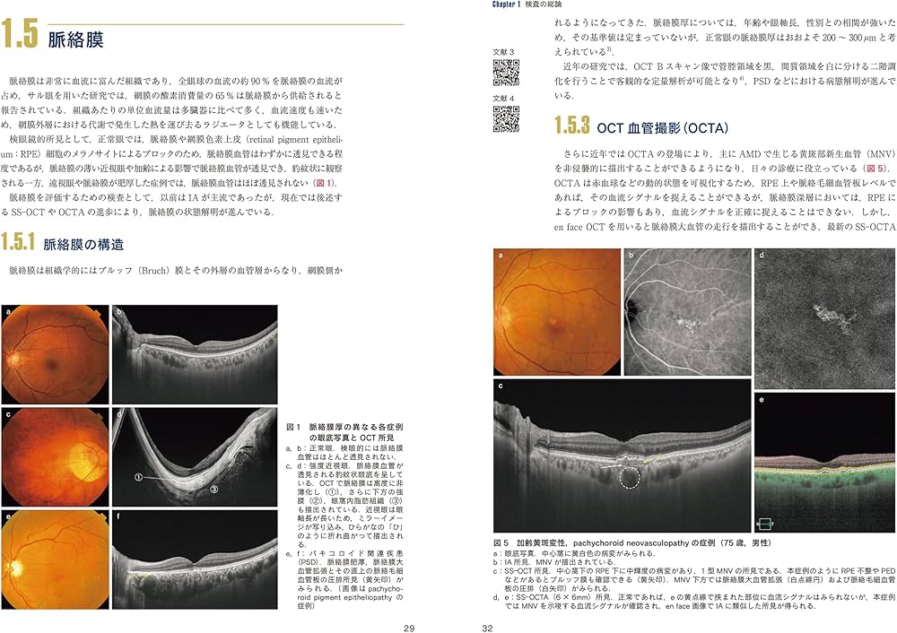 最新 眼科画像診断パワーアップ (眼科診療エクレール 2) | 辻川明孝