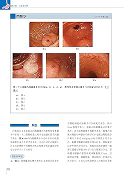 日本消化器内視鏡学会専門医学術試験問題 解答と解説 第5版 | 一般社団