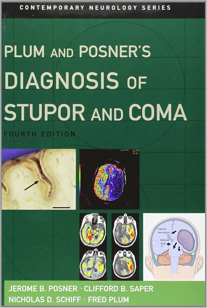 Amazon | Plum and Posner's Diagnosis of Stupor and Coma