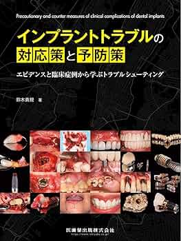 81YFSkcopDL._AC_UF350,