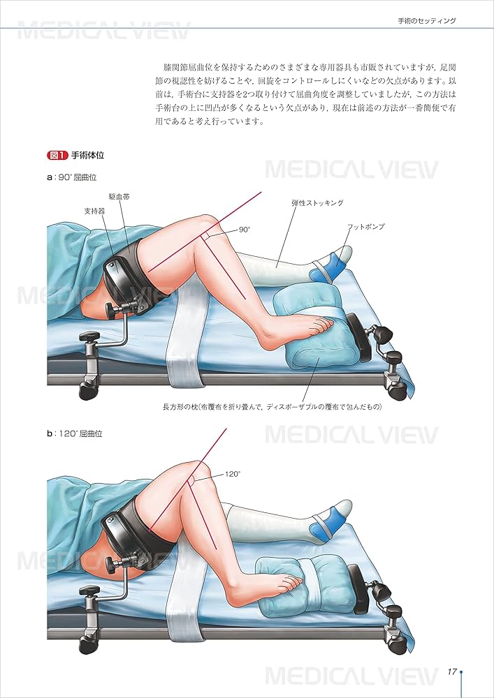 阪和人工関節センター TKAマニュアル−Basic Course | 格谷 義徳 |本