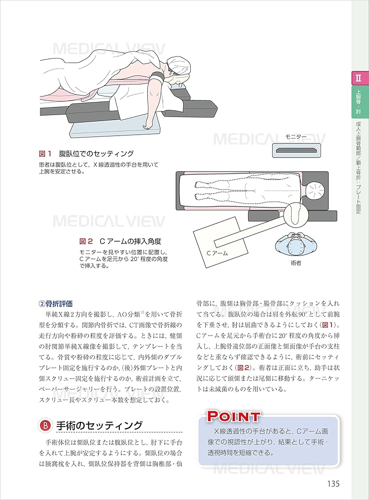スタンダード骨折手術治療 上肢 | 渡部 欣忍 |本 | 通販 | Amazon