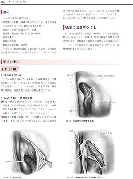 81bOtIJItRL._AC_UF350,
