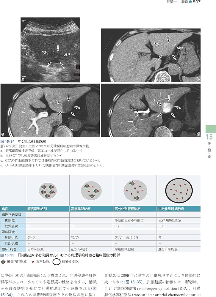 Amazon.co.jp: 標準病理学 第7版 (Standard Textbook) : 北川 昌伸