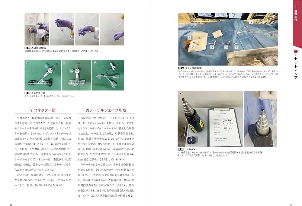 脳血管内治療の基本テクニック：コマ送り解説で知識と技術が結びつく