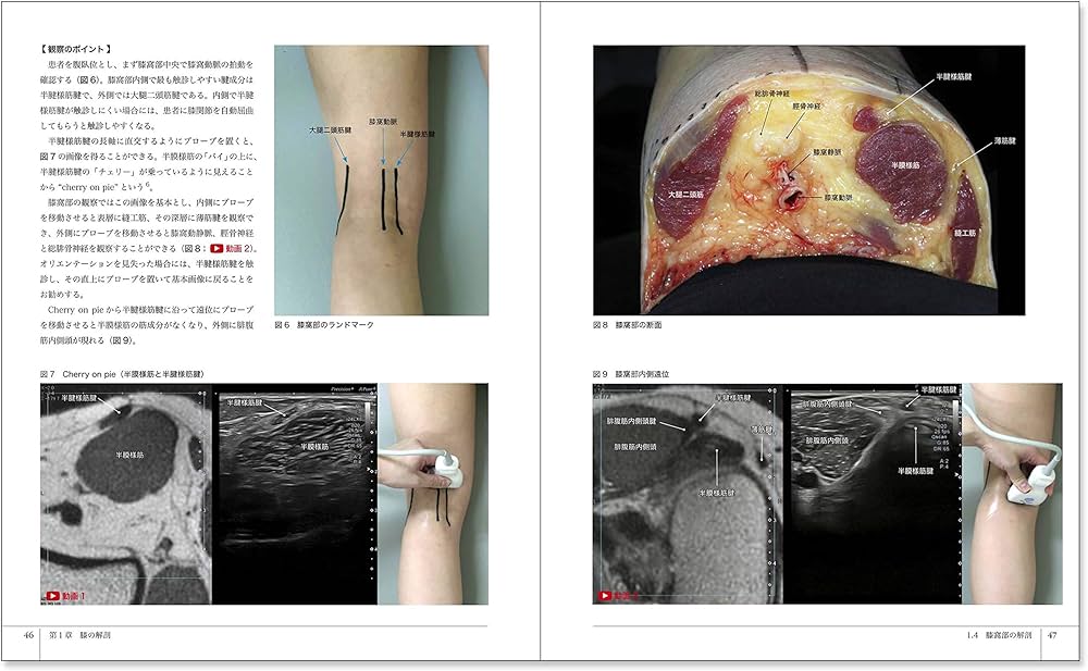 膝エコーのすべて〈解剖・診断・インターベンション〉 | 中瀬 順介