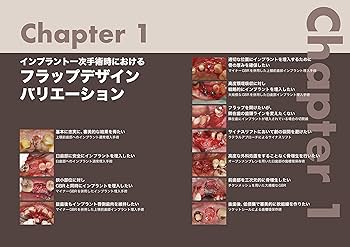 このシチュエーションにこの切開Flap Design Album | 岡村知彦・富塚